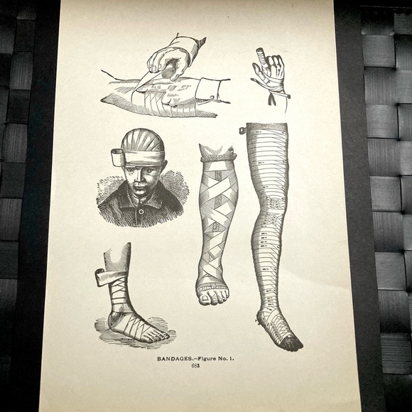 Vintage Medical Diagram | Bandages | Circa 1903 - Picture 1 of 6